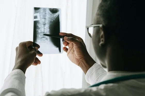 ortopedico mirando rayos x rx negro columna cervical
