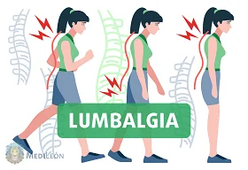 lumbalgia, lumbago, dolor lumbar, lumbociatalgia, traumatologia, columna vertebral. columna lumbar