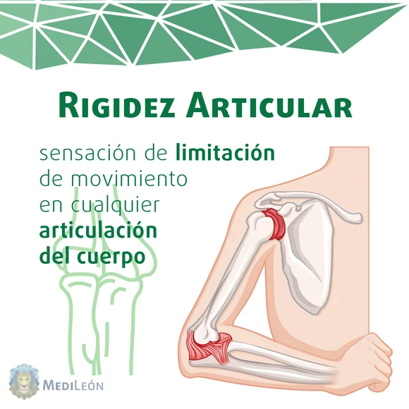 la rigidez articular es una sensacion de limitacion de movimiento