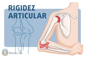 rigidez articular traumatologia y ortopedia hombro cadera mano rodilla